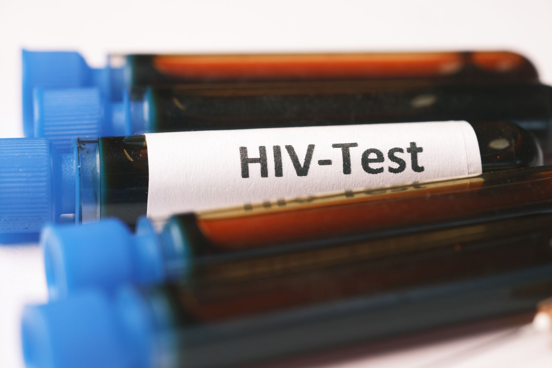 Namakwa Health Department urges TB screenings for early detection